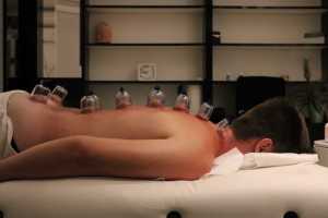 CUPPING-TERAPIJA